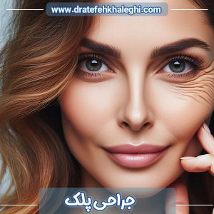 جراحی پلک در اهواز - دکتر عاطفه خالقی