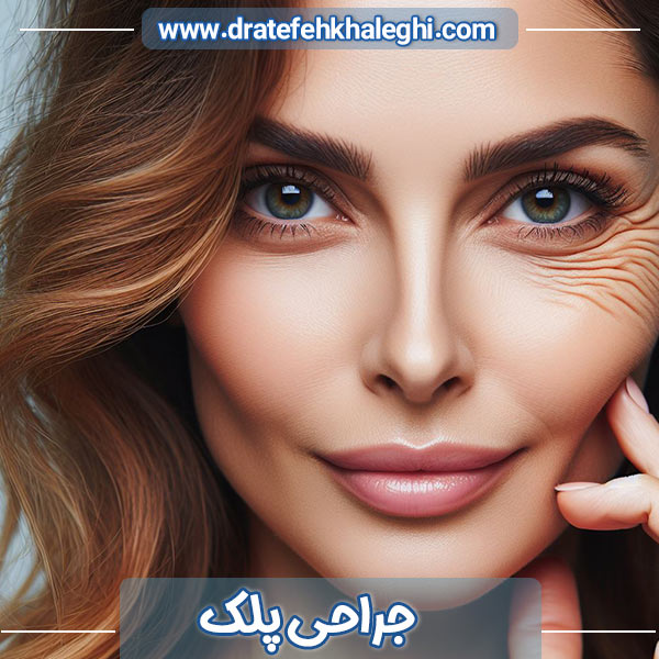 جراحی پلک در اهواز - دکتر عاطفه خالقی