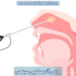 جراحی آندوسکوپی سینوس در اهواز - دکتر خالقی