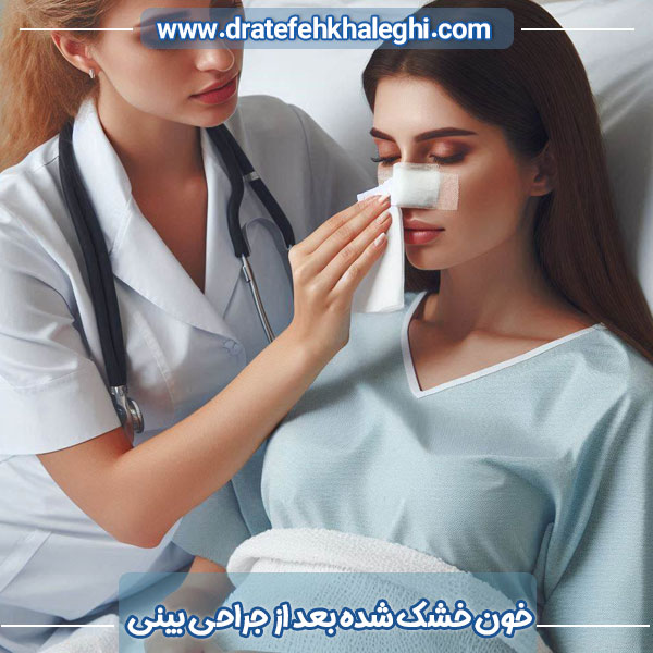 خون خشک شده بعد از عمل بینی - دکتر عاطفه خالقی