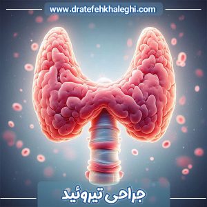 جراحی تیروئید در اهواز - دکتر عاطفه خالقی 