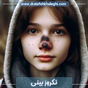 نکروز بینی - https://dratefehkhaleghi.com/
