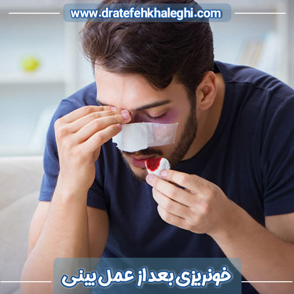 عکس خونریزی بعد از عمل بینی