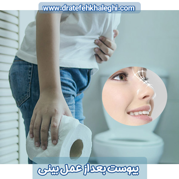 یبوست بعد از عمل بینی