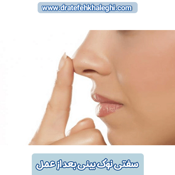 سفتی نوک بینی بعد از عمل